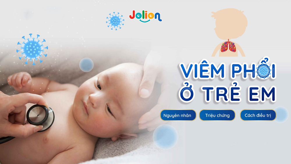 Dấu hiệu bệnh viêm phổi ở trẻ em hình 1