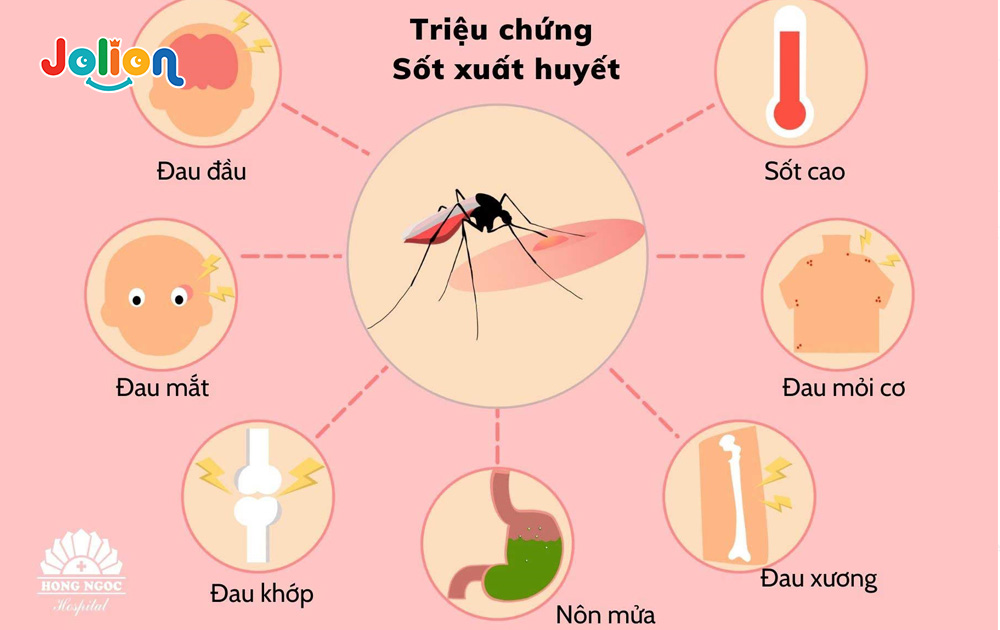 Sốt xuất huyết ở trẻ em là gì?